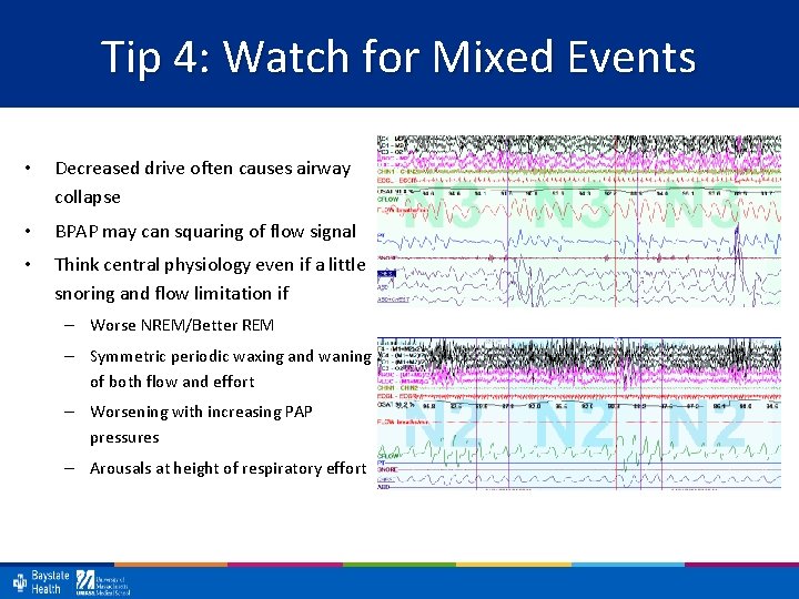 Tip 4: Watch for Mixed Events • Decreased drive often causes airway collapse •