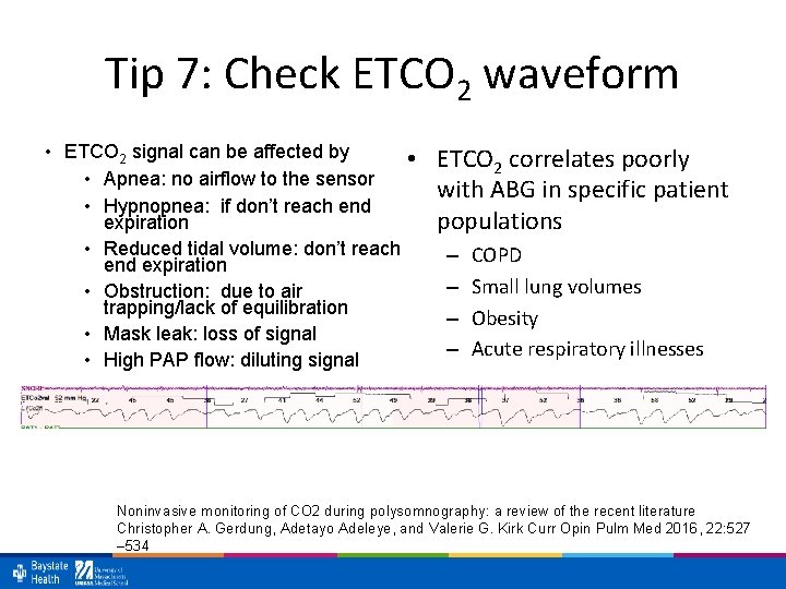 Tip 7: Check ETCO 2 waveform • ETCO 2 signal can be affected by