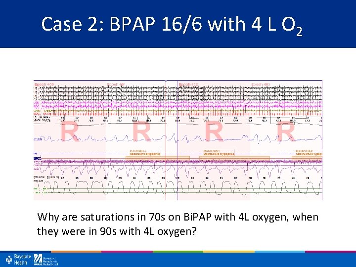 Case 2: BPAP 16/6 with 4 L O 2 Why are saturations in 70