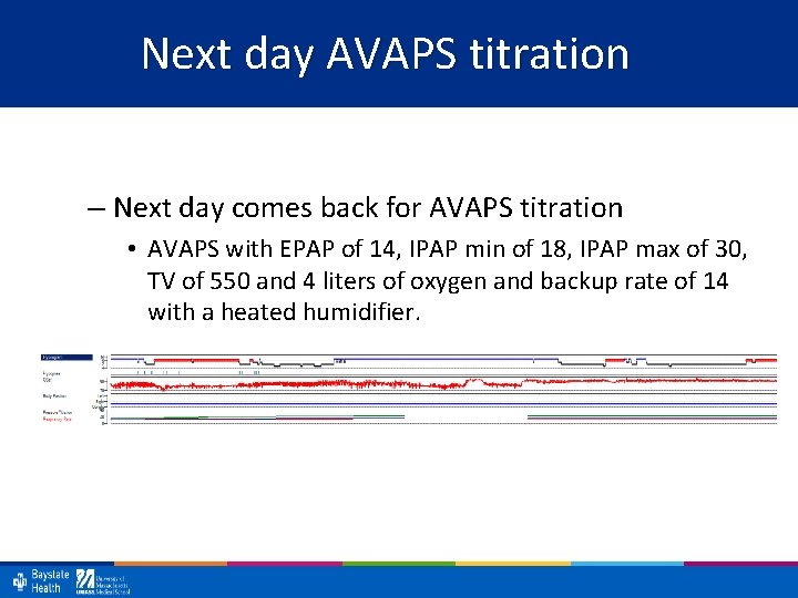 Next day AVAPS titration – Next day comes back for AVAPS titration • AVAPS