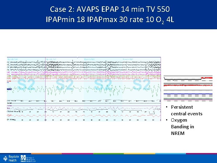 Case 2: AVAPS EPAP 14 min TV 550 IPAPmin 18 IPAPmax 30 rate 10