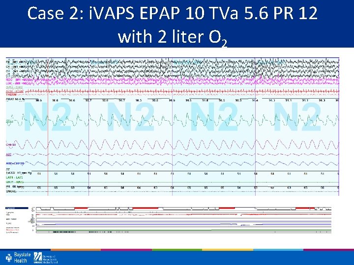 Case 2: i. VAPS EPAP 10 TVa 5. 6 PR 12 with 2 liter