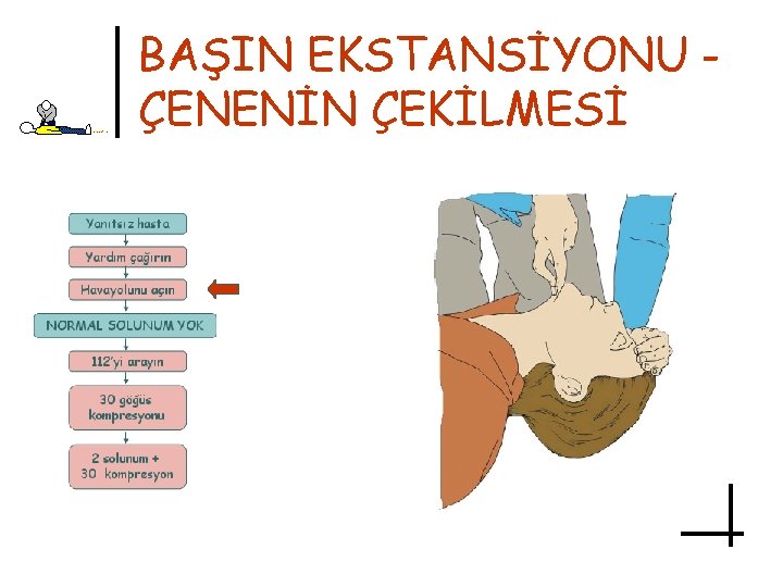 BAŞIN EKSTANSİYONU ÇENENİN ÇEKİLMESİ 