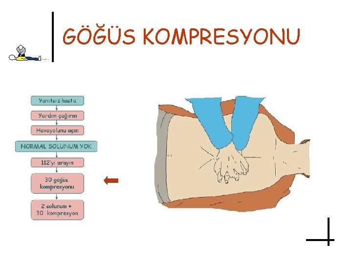 GÖĞÜS KOMPRESYONU 