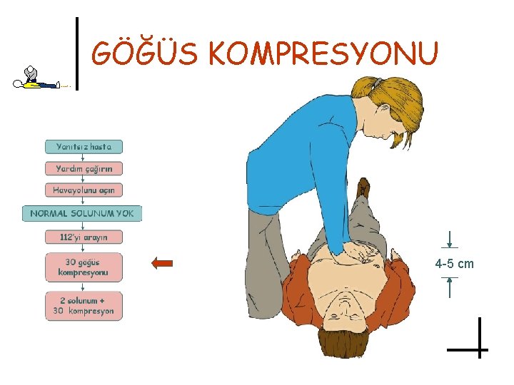 GÖĞÜS KOMPRESYONU 4 -5 cm 