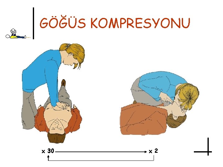 GÖĞÜS KOMPRESYONU x 30 x 2 