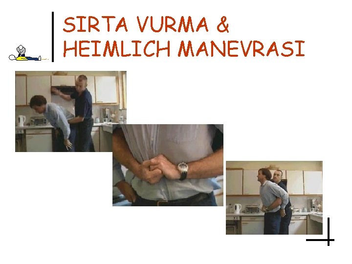 SIRTA VURMA & HEIMLICH MANEVRASI 