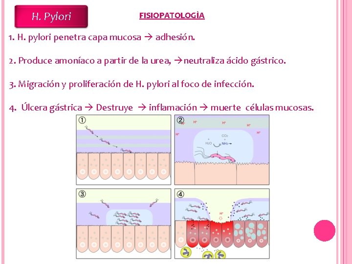 H. Pylori FISIOPATOLOGÌA 1. H. pylori penetra capa mucosa adhesión. 2. Produce amoníaco a