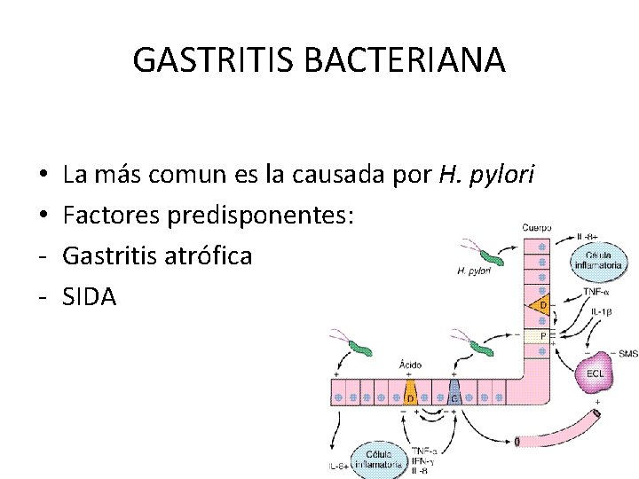 GASTRITIS BACTERIANA • • - La más comun es la causada por H. pylori