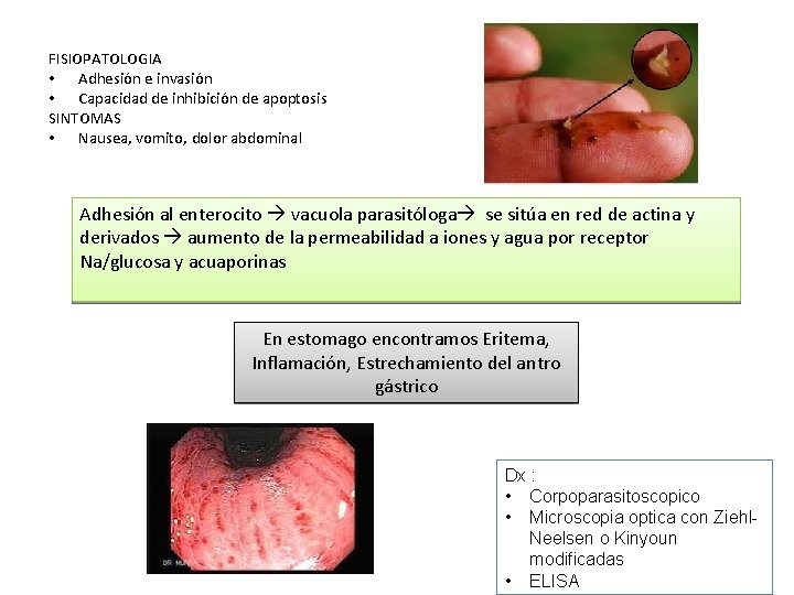 FISIOPATOLOGIA • Adhesión e invasión • Capacidad de inhibición de apoptosis SINTOMAS • Nausea,