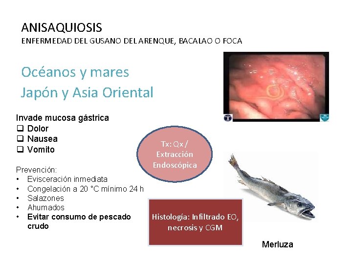 ANISAQUIOSIS ENFERMEDAD DEL GUSANO DEL ARENQUE, BACALAO O FOCA Océanos y mares Japón y