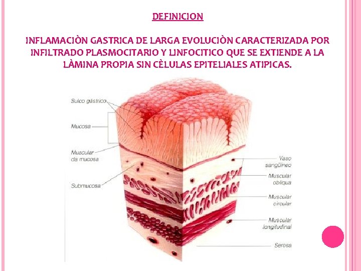 DEFINICION INFLAMACIÒN GASTRICA DE LARGA EVOLUCIÒN CARACTERIZADA POR INFILTRADO PLASMOCITARIO Y LINFOCITICO QUE SE