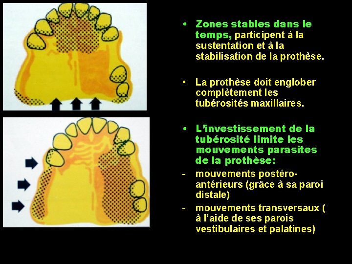  • Zones stables dans le temps, participent à la sustentation et à la