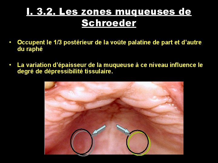 I. 3. 2. Les zones muqueuses de Schroeder • Occupent le 1/3 postérieur de