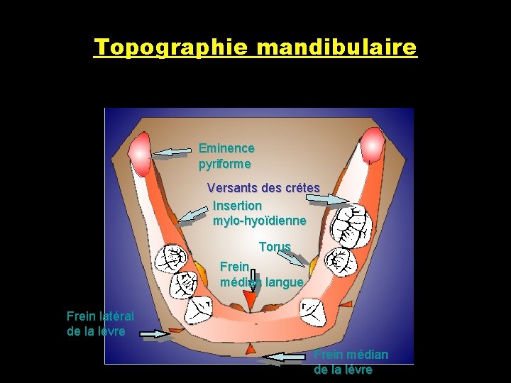 Topographie mandibulaire Eminence pyriforme Versants des crétes Insertion mylo-hyoïdienne Torus Frein médian langue Frein