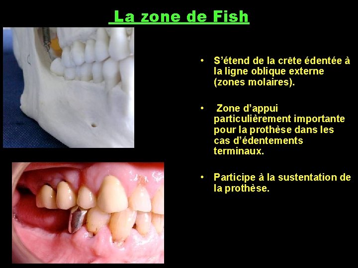 La zone de Fish • S’étend de la crête édentée à la ligne oblique