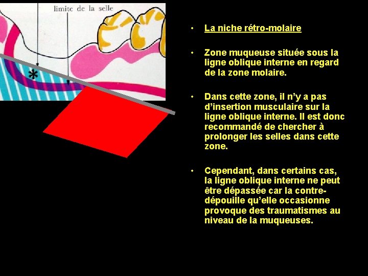  • La niche rétro-molaire • Zone muqueuse située sous la ligne oblique interne