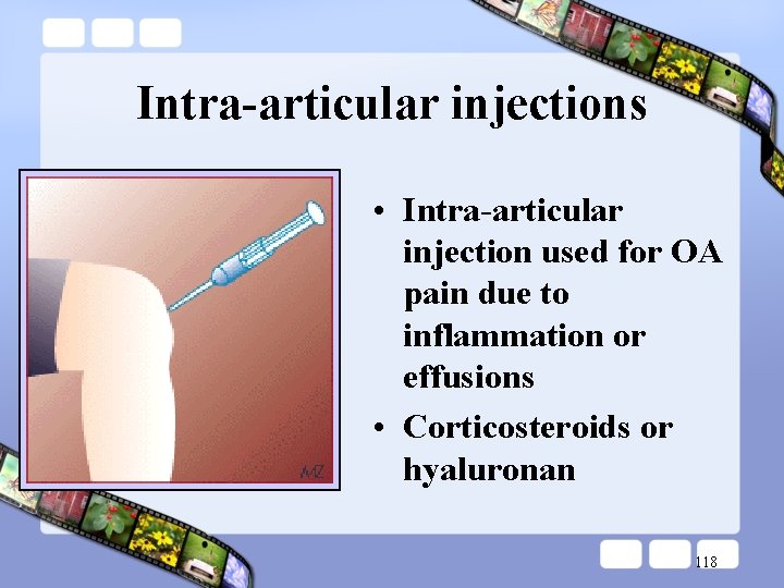 Intra-articular injections • Intra-articular injection used for OA pain due to inflammation or effusions