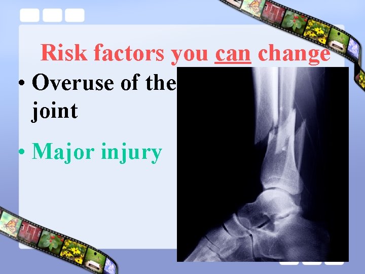 Risk factors you can change • Overuse of the joint • Major injury 