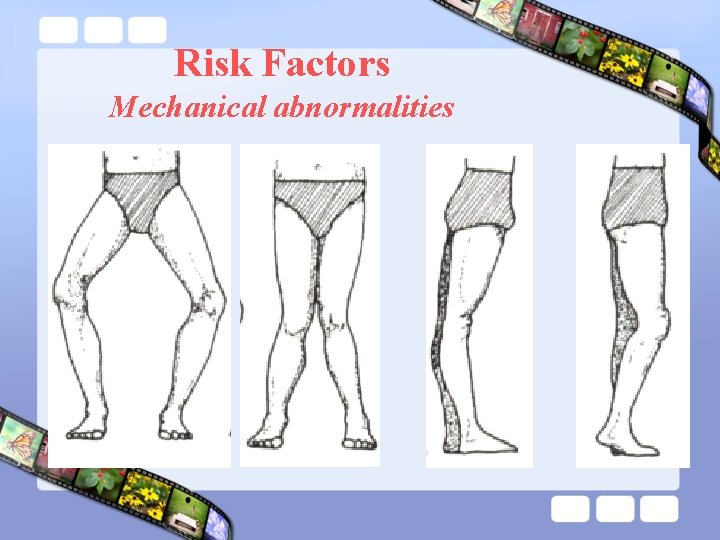 Risk Factors Mechanical abnormalities 