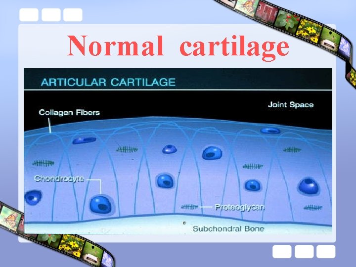 Normal cartilage 