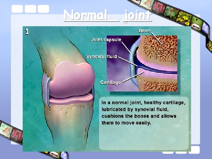 Normal joint 