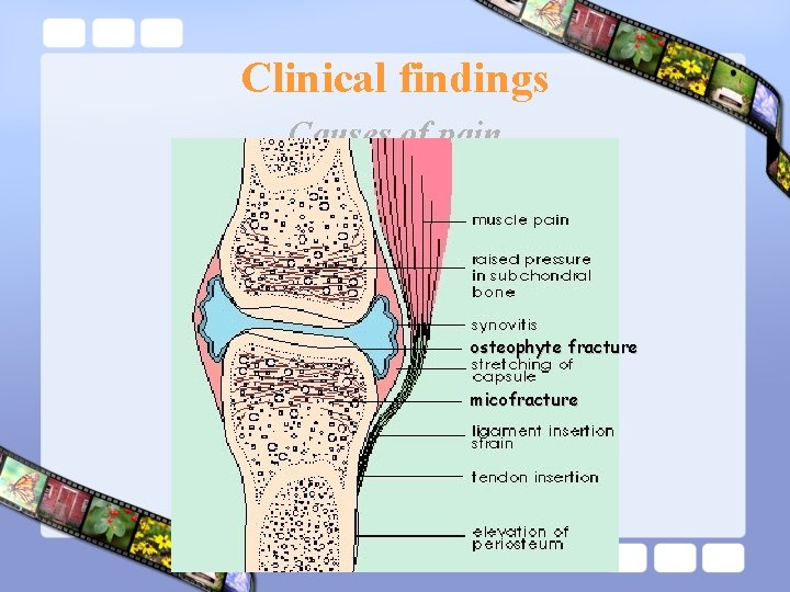 Clinical findings Causes of pain osteophyte fracture micofracture 