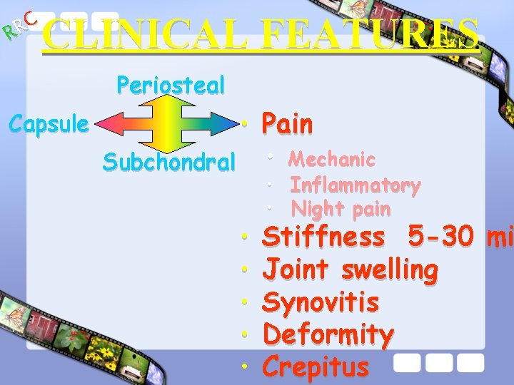 C R R CLINICAL FEATURES Periosteal Capsule • Pain Subchondral • Mechanic • •
