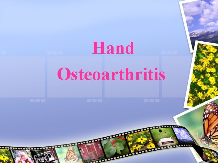 Hand Osteoarthritis 