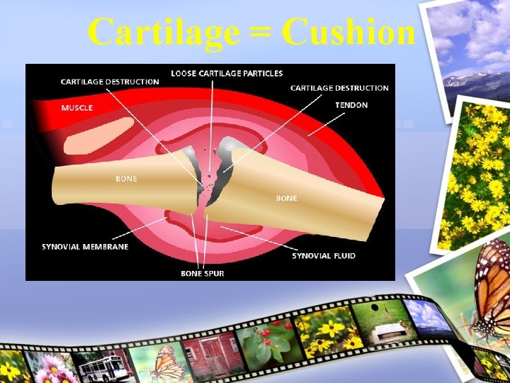 Cartilage = Cushion 