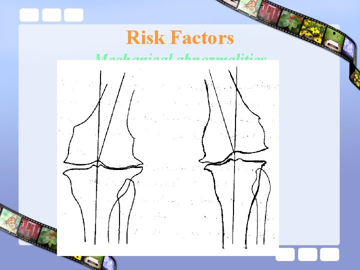 Risk Factors Mechanical abnormalities 