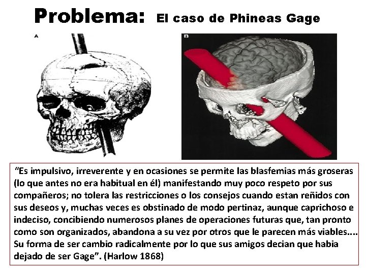 Problema: El caso de Phineas Gage “Es impulsivo, irreverente y en ocasiones se permite