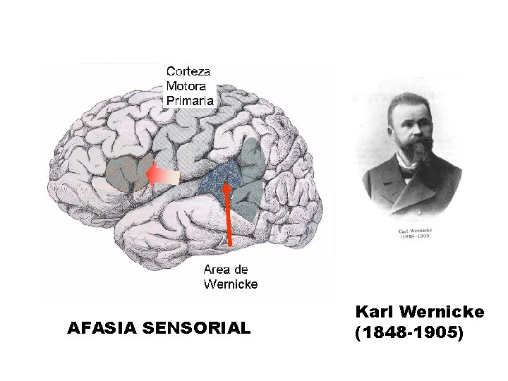 AFASIA SENSORIAL Karl Wernicke (1848 -1905) 