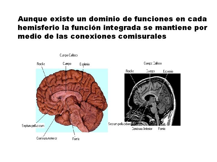 Aunque existe un dominio de funciones en cada hemisferio la función integrada se mantiene