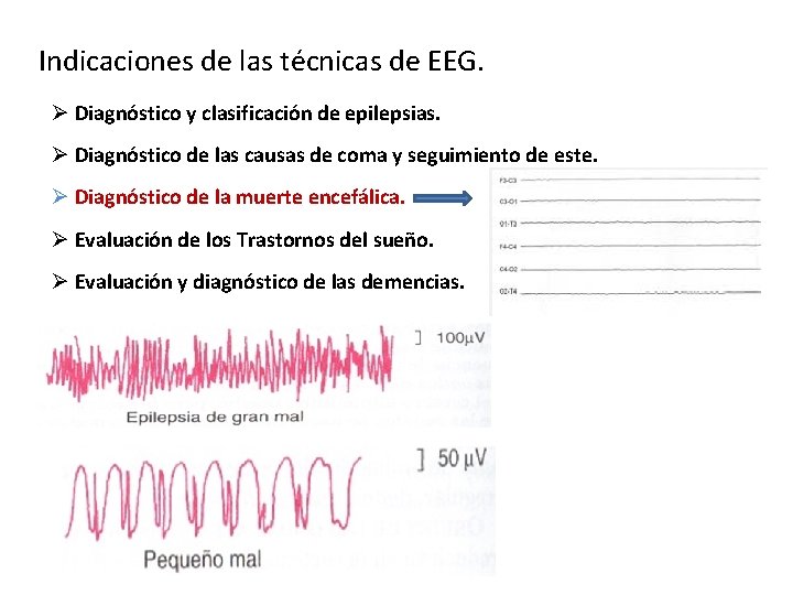 Indicaciones de las técnicas de EEG. Ø Diagnóstico y clasificación de epilepsias. Ø Diagnóstico