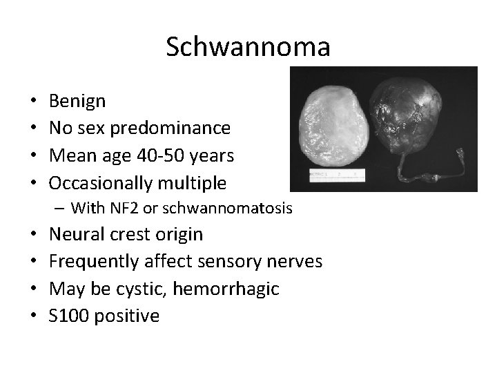 Schwannoma • • Benign No sex predominance Mean age 40 -50 years Occasionally multiple