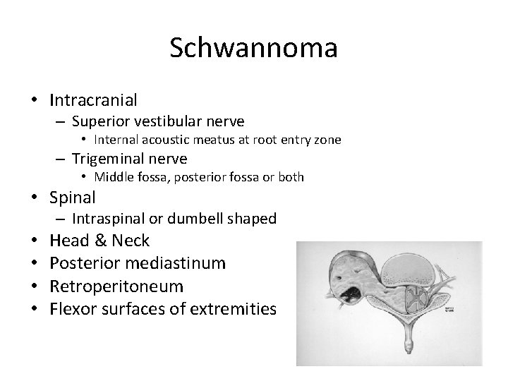 Schwannoma • Intracranial – Superior vestibular nerve • Internal acoustic meatus at root entry