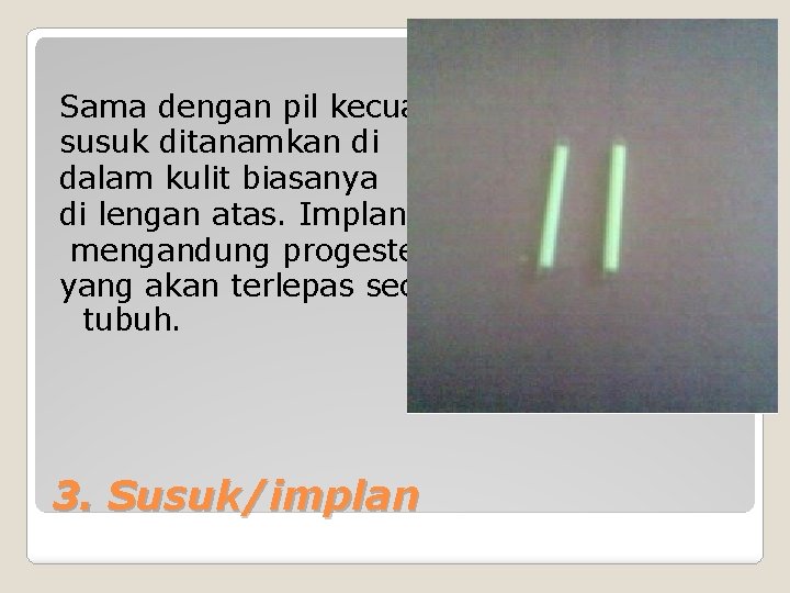 Sama dengan pil kecuali susuk ditanamkan di dalam kulit biasanya di lengan atas. Implan