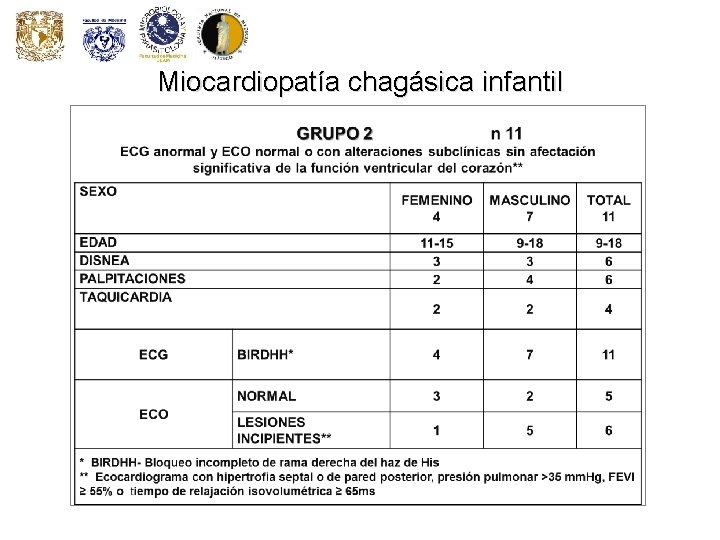 Miocardiopatía chagásica infantil Miocardiopatía chagásica infantil