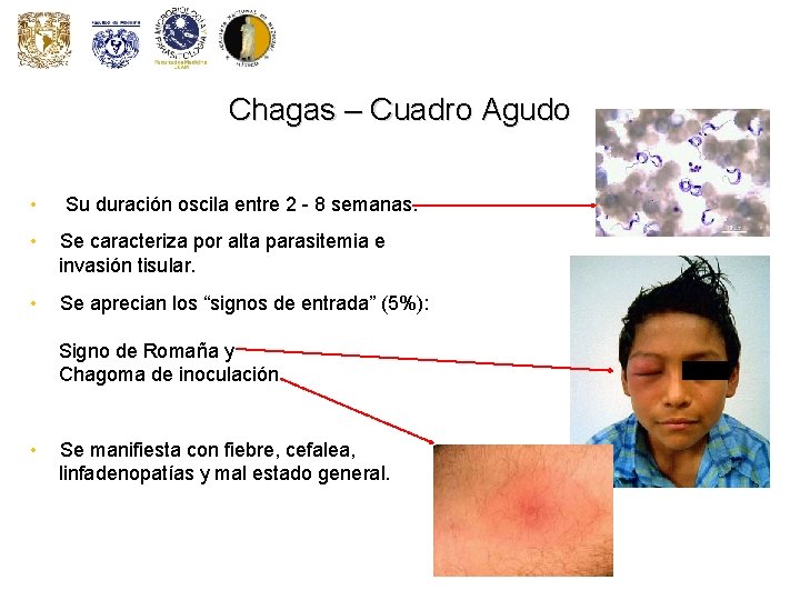 Chagas – Cuadro Agudo • Su duración oscila entre 2 - 8 semanas. • Chagas – Cuadro Agudo • Su duración oscila entre 2 - 8 semanas. •