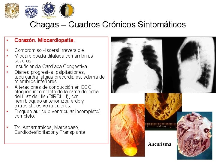 Chagas – Cuadros Crónicos Sintomáticos • Corazón. Miocardiopatía. • • Compromiso visceral irreversible. Miocardiopatía Chagas – Cuadros Crónicos Sintomáticos • Corazón. Miocardiopatía. • • Compromiso visceral irreversible. Miocardiopatía