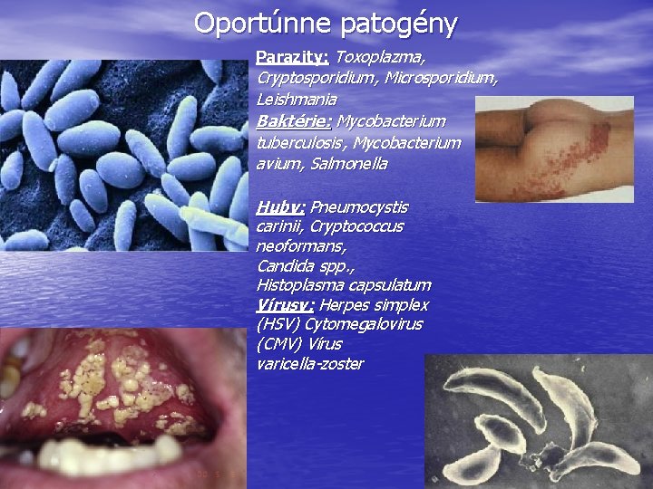 Oportúnne patogény Parazity: Toxoplazma, Cryptosporidium, Microsporidium, Leishmania Baktérie: Mycobacterium tuberculosis, Mycobacterium avium, Salmonella Huby: