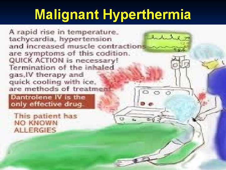 Malignant Hyperthermia 