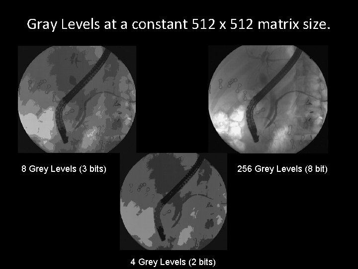 Gray Levels at a constant 512 x 512 matrix size. 8 Grey Levels (3
