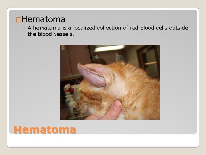 �Hematoma ◦ A hematoma is a localized collection of red blood cells outside the �Hematoma ◦ A hematoma is a localized collection of red blood cells outside the