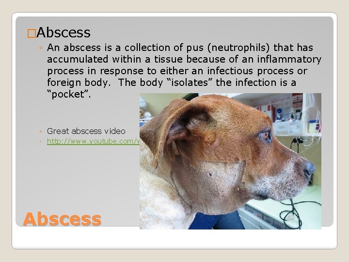 �Abscess ◦ An abscess is a collection of pus (neutrophils) that has accumulated within