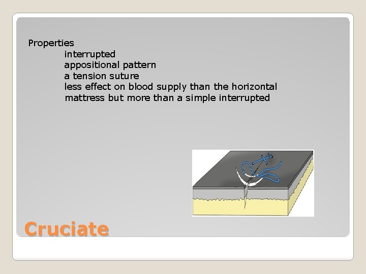 Properties interrupted appositional pattern a tension suture less effect on blood supply than the