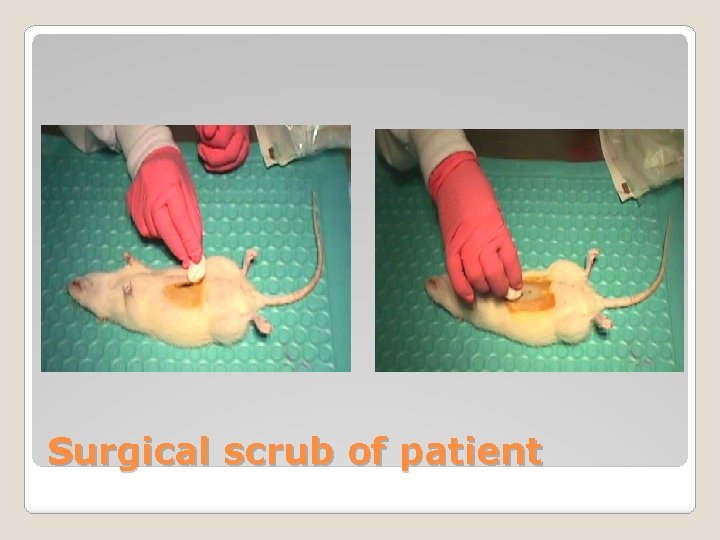 Surgical scrub of patient 