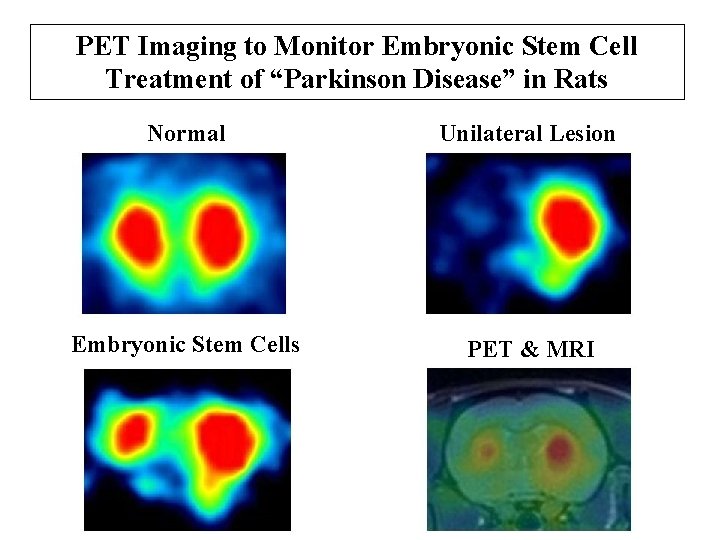 PET Imaging to Monitor Embryonic Stem Cell Treatment of “Parkinson Disease” in Rats Normal