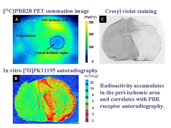 [11 C]PBR 28 PET summation image A Peri-ischemic area Contralateral Cresyl violet staining (%SUV)